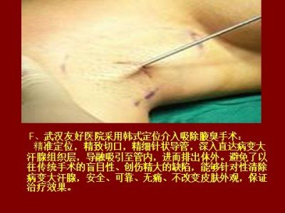 庆祝中国人民解放军98周年 中国当代名医——汪学军