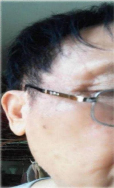特别报道量子氢氧健康第一人长寿哥(廖永贵)　