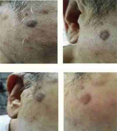 量子氢氧健康第一人长寿哥(廖永贵)  让科学量氢氧品牌走向世界!