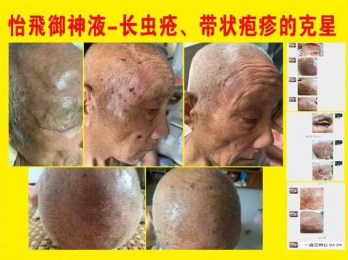 医道同源 慧慈济世 悟慧慈智法师的中医药文化传承之路