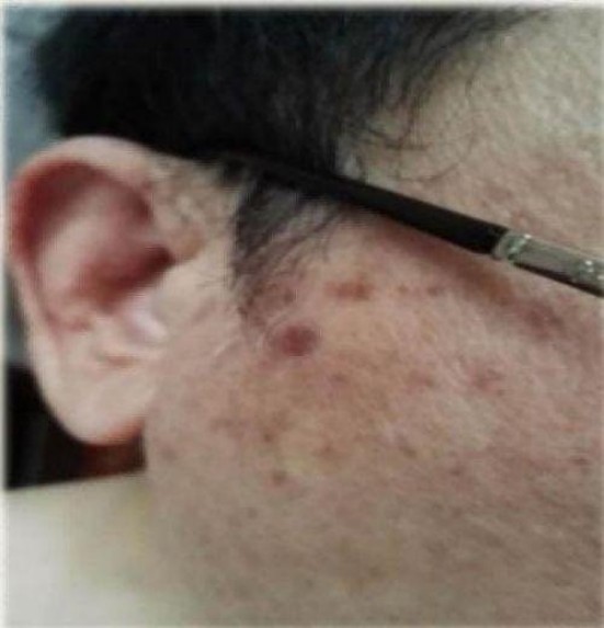 量子氢氧健康第一人长寿哥(廖永贵) 让科学量氢氧品牌走向世界!